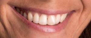 zdravi zobje in dlesni